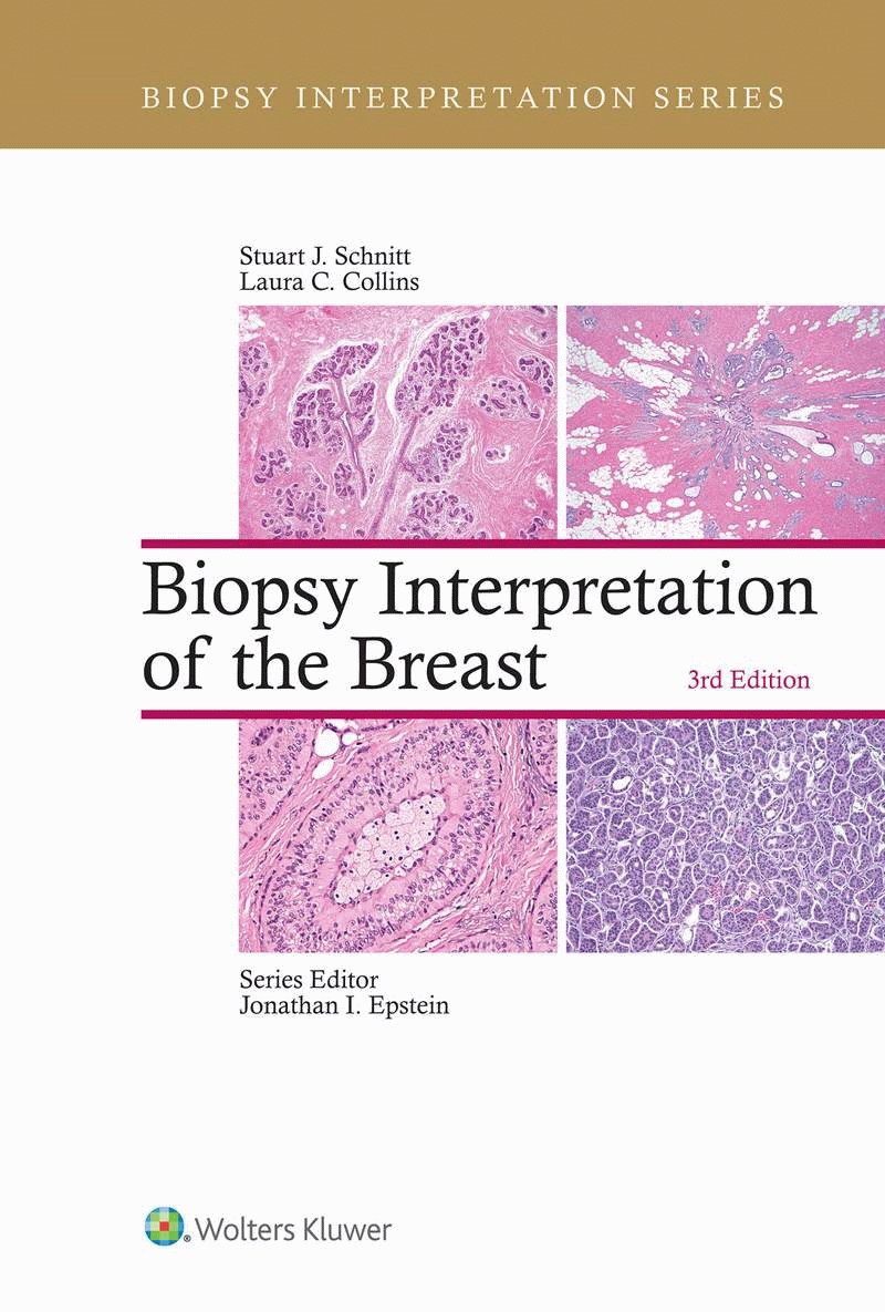 Biopsy Interpretation of the Breast. 표지이미지
